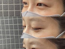 ビオールイースト(Be All east)/カラーエクステ