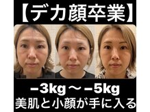 ハリック(HaRick)/【デカ顔卒業】