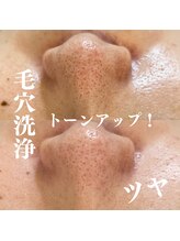 モンレーヴ(MonReve)/毛穴洗浄