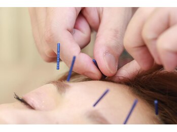 エムアンドエス鍼灸整骨院(M&S鍼灸整骨院)/美顔鍼