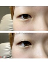 ボアソルチ(BOA SORTE)/しっかりカール！