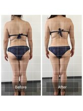 ボディメイクサロンアプローズ/背中肉流れに変化