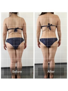 ボディメイクサロンアプローズ/背中肉流れに変化