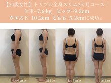 エターナルフレーム(Eternal Flame)/34歳トリプル全身スリム