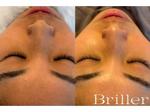 ブリエ(Briller)/毛穴洗浄＋鎮静パック