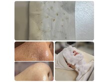 ≪エリア希少/感動毛穴◎毛穴二刀流エクストラクション≫