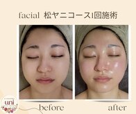 パーソナル ユニ(uni)