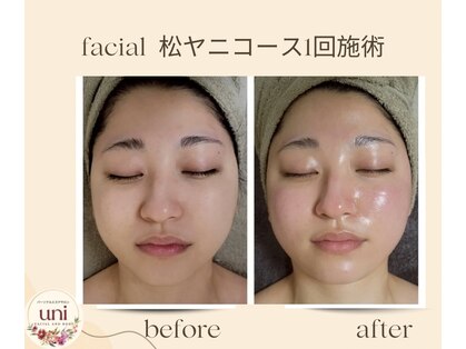 パーソナル ユニ(uni)の写真