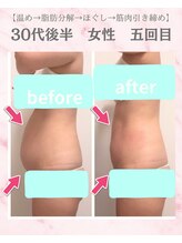 リラ(Lilas)/【痩身】ぽっこりお腹解消