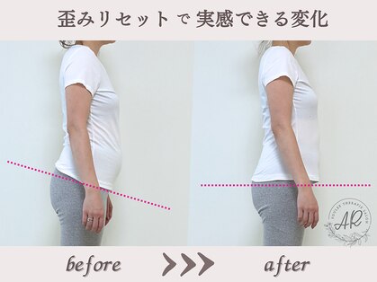 エーアール(AR)の写真