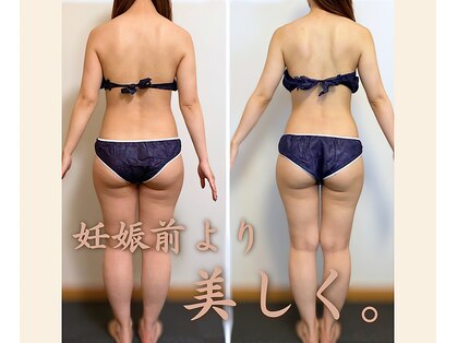 整体ルーム ココロ 金沢(Cocoro)の写真