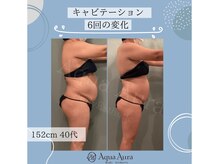 ボディエステティック アクアオーラ 高岡店/お腹まわりに変化が♪