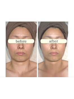 お肌をきれいにしたい