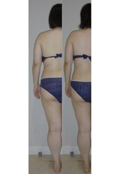 アルマ 芦屋(ALMA)/左半身の比較☆