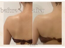 アンバー 恵比寿(AMBER)の雰囲気（【ブライダル】1ヶ月前駆け込み痩身◎まずは1度ご体感ください♪）