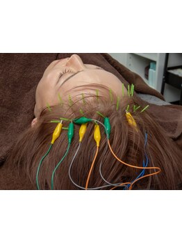 鍼灸施術を受けたい