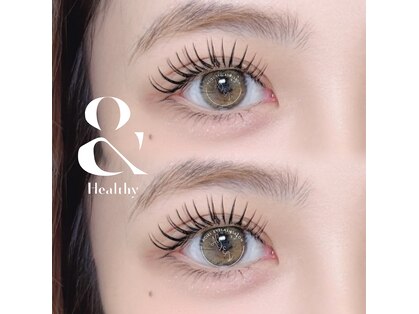 エイシェルの写真