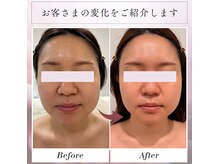 ビビラフィネ(BiBi Raffine)の雰囲気（たるみ・毛穴をケアし、透明感あふれる若々しい印象へ導きます）