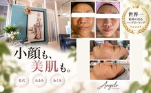 アンジェロ(Angelo)