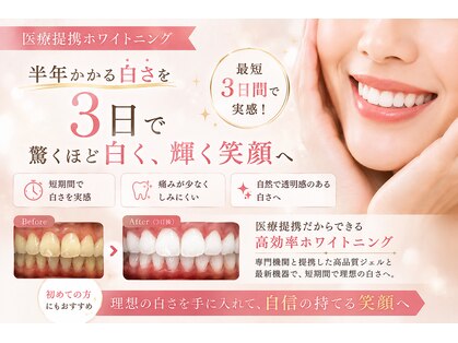 クレン(CLEN)の写真