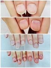 ユリシスネイル(ULYSSES NAIL)/地爪ネイルケア