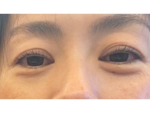 ビューティーアミューズメント 山鼻店(BEAUTY AMUSEMENT)/岩切7月16日