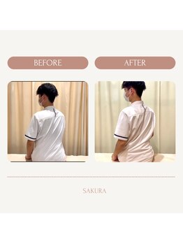 さくら整体院/Bifore→After