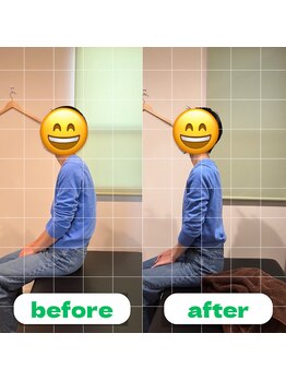 ナオル整体 長崎大村院(NAORU整体)/40代女性施術事例【猫背矯正】