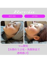 レビア(Revia)/フェイスWax/before→after/美肌