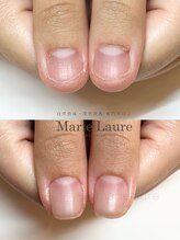 マリーロール 淀屋橋本店(Marie Laure)/自爪育成/深爪矯正/ネイルケア