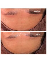 プライベートサロン アール(R)/コルギ（フェイシャル）