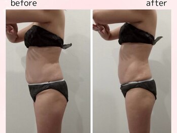 スキンスタジオ レア(Lea)/