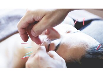 花園わだち整骨院の写真/ニキビケア・シワたるみ改善や小顔など、お顔の血行促進でいつもの化粧水が入りやすいお肌に◎【美容鍼】