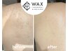 【匠道WAX】和装やドレスを着る前に◆うなじ背中上WAX脱毛　初回8800円