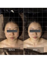 グレースフィオーレ 西宮北口店(gracefiore)/施術後Before/After 