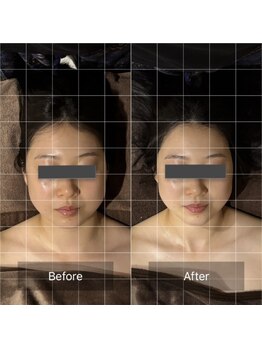グレースフィオーレ 西宮北口店(gracefiore)/施術後Before/After 
