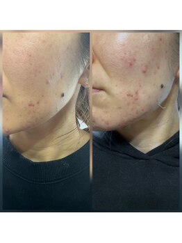 アイ クイーン 押上店(Eye queen)/