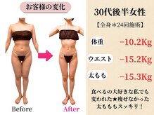 ベルホワイト(Belle White)/【30代後半/6ヶ月の変化】