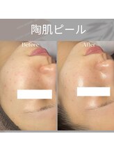 ブラックボックス(BLACK BOX)/20代女性のお客様