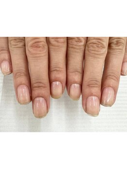 爪の悩みを解消できる（ケア含む）