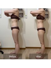 エミニー(EMINY)/