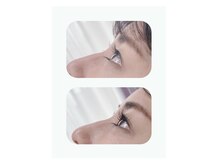 ファーストアイ(First eye)