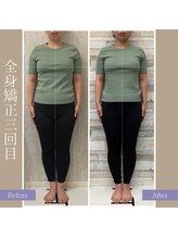 キアラ(chiara)/全身矯正3回目(正面)