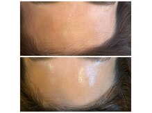 LINEご予約プレゼント有/キャンペーン情報はInstagramより