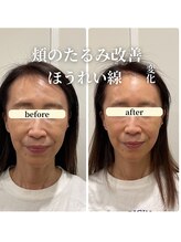 フェアリーフェイス 南森町店(Fairy Face)/南森町/小顔矯正&レモンボトル