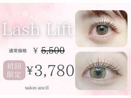 アンシル(ANCIL)の写真