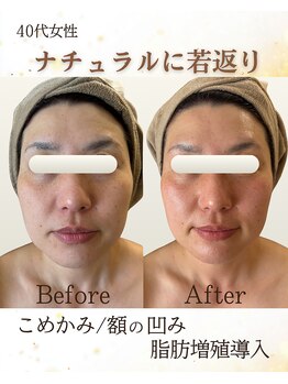 ビエン 福岡古賀(BiEN)/【頬骨感を減らして若見え】小顔