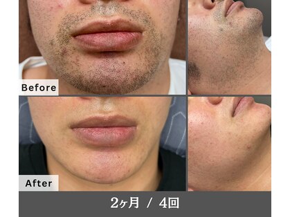 バディーズ(BUDDieS)の写真