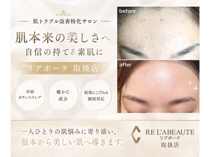 アンテイン チル(anthein chill)の写真