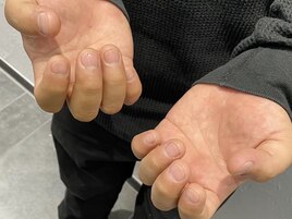 ネイルケア